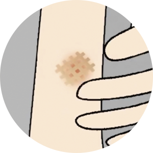 Microlift Activates